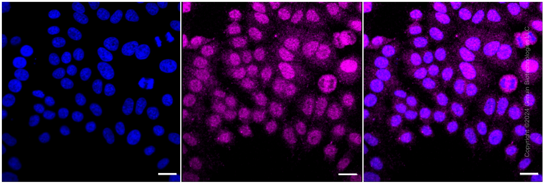 KD-Validated Anti-Cyclin dependent kinase 5 Rabbit Monoclonal Antibody ABG1004