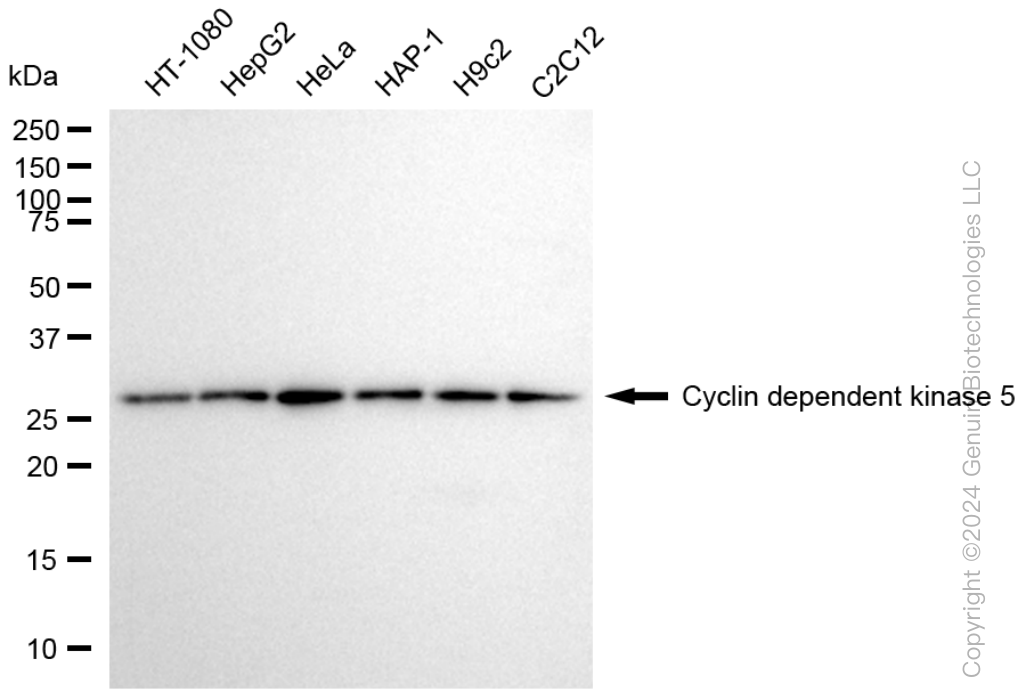 KD-Validated Anti-Cyclin dependent kinase 5 Rabbit Monoclonal Antibody ABG1004