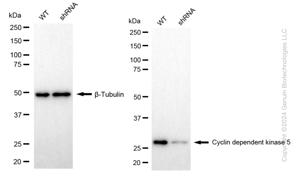 KD-Validated Anti-Cyclin dependent kinase 5 Rabbit Monoclonal Antibody ABG1004