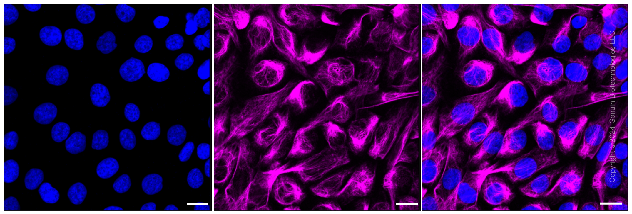 KD-Validated Anti-ACAP2 Rabbit Monoclonal Antibody ABG1005