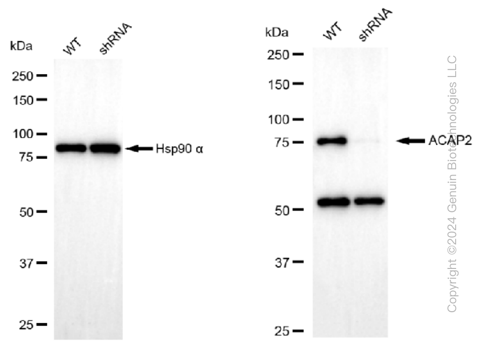 KD-Validated Anti-ACAP2 Rabbit Monoclonal Antibody ABG1005