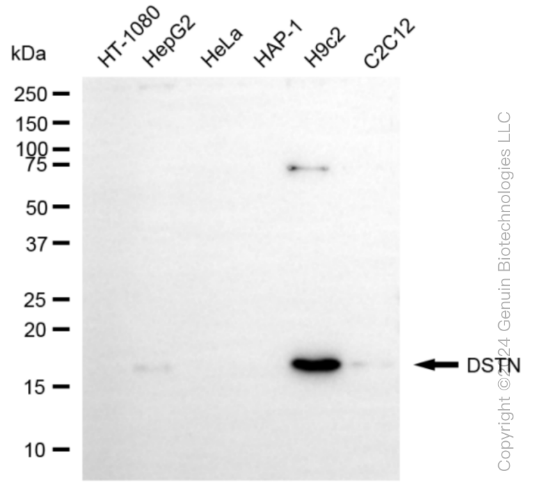 KD-Validated Anti-DSTN Rabbit Monoclonal Antibody ABG1008