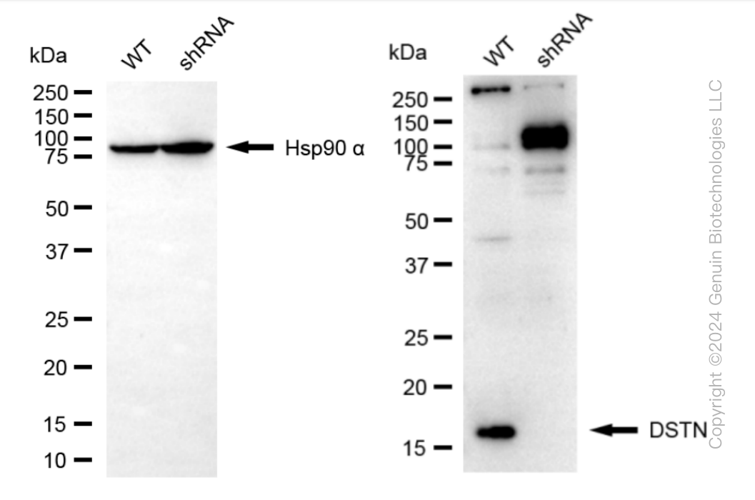 KD-Validated Anti-DSTN Rabbit Monoclonal Antibody ABG1008