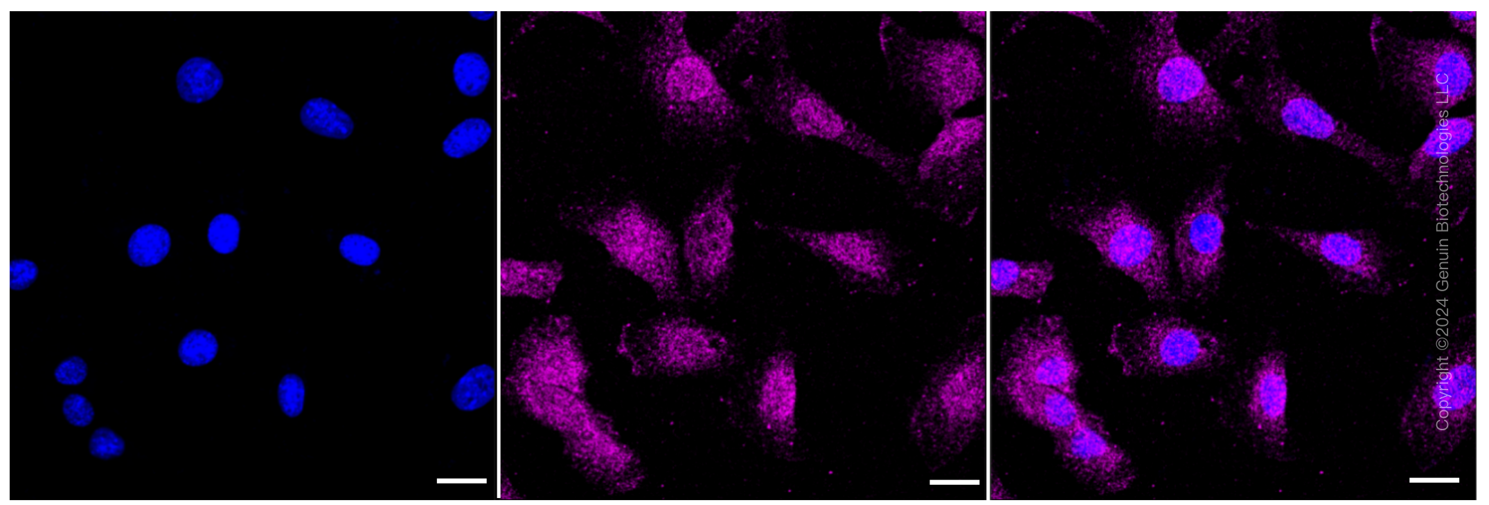 KD-Validated Anti-MAP1LC3A Rabbit Monoclonal Antibody ABG1011