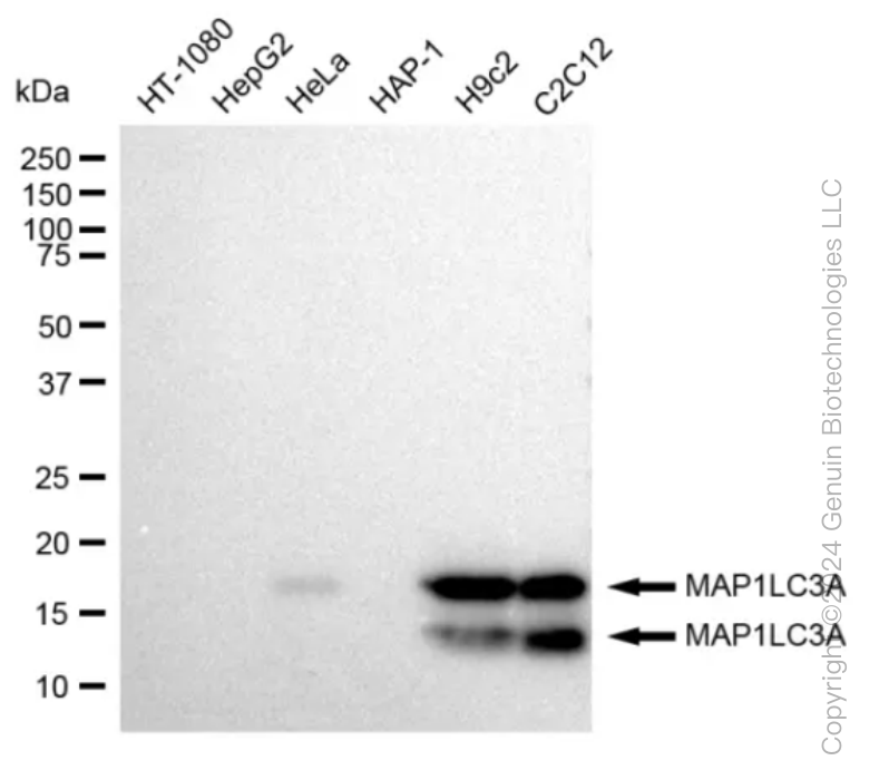 KD-Validated Anti-MAP1LC3A Rabbit Monoclonal Antibody ABG1011