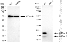KD-Validated Anti-MAP1LC3A Rabbit Monoclonal Antibody ABG1011