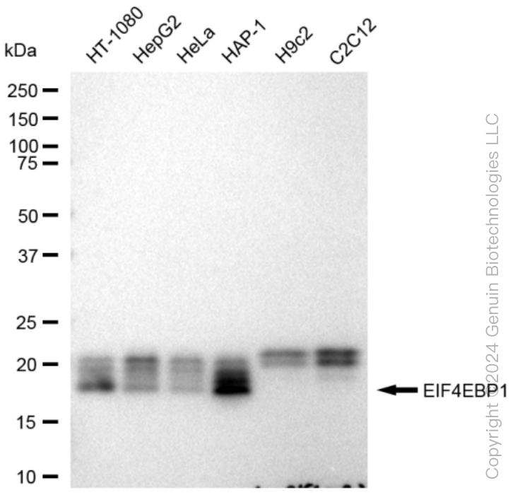 KD-Validated Anti-EIF4EBP1 Rabbit Monoclonal Antibody ABG1015