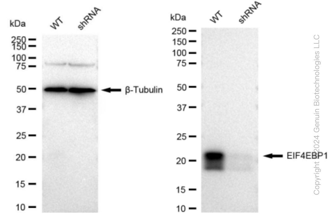 KD-Validated Anti-EIF4EBP1 Rabbit Monoclonal Antibody ABG1015
