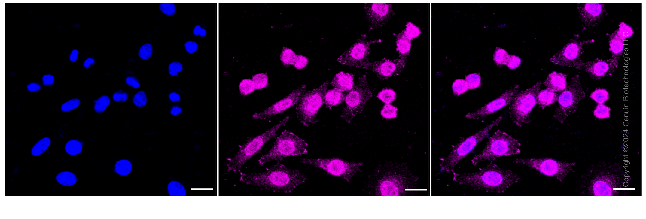 KD-Validated Anti-C4BPB Rabbit Monoclonal Antibody ABG1018