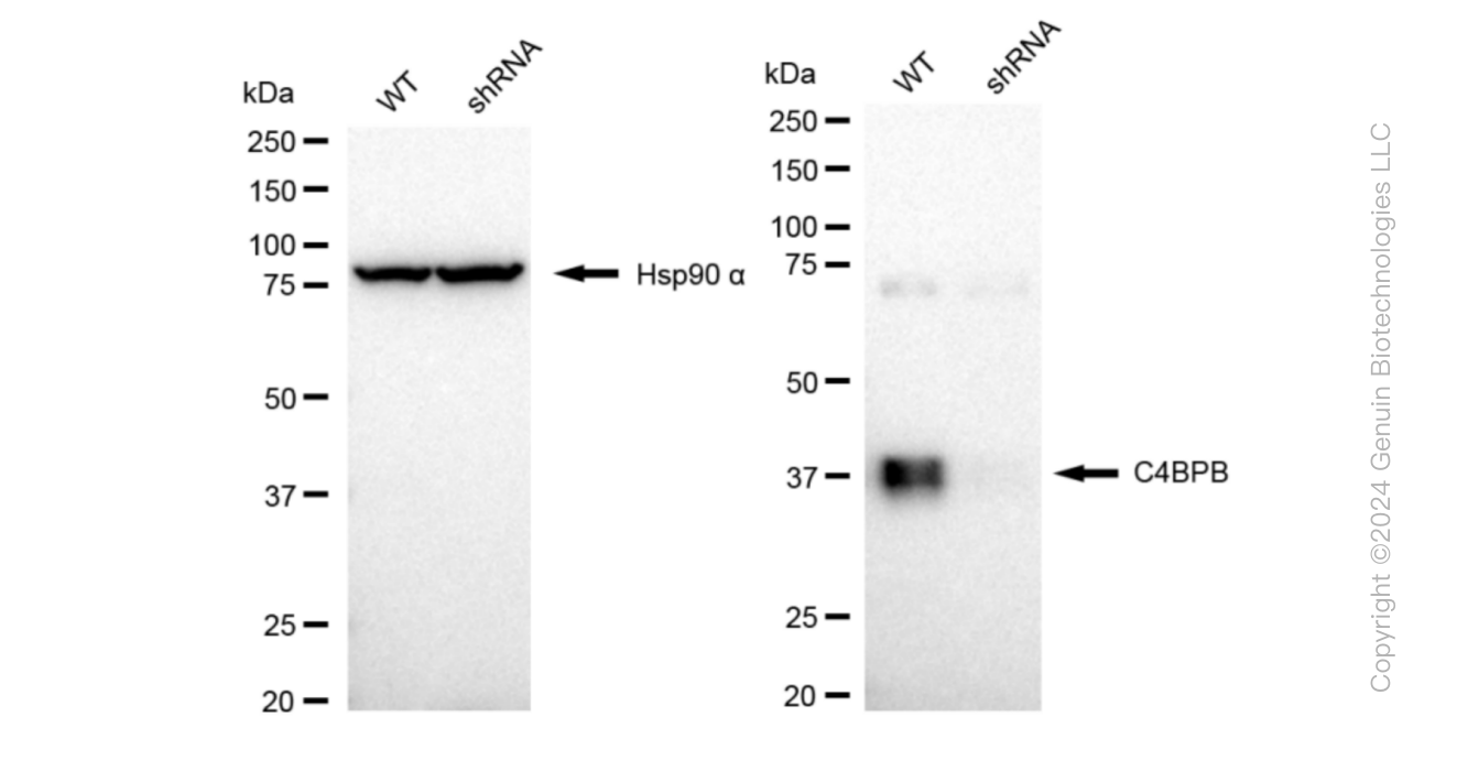 KD-Validated Anti-C4BPB Rabbit Monoclonal Antibody ABG1018