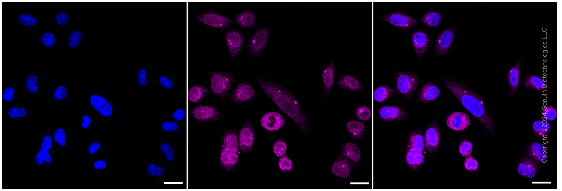 KD-Validated Anti-Nucleoporin 155 Rabbit Monoclonal Antibody ABG1020