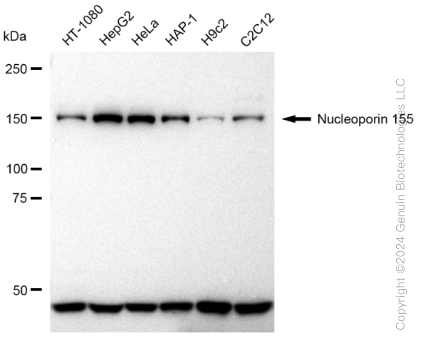 KD-Validated Anti-Nucleoporin 155 Rabbit Monoclonal Antibody ABG1020