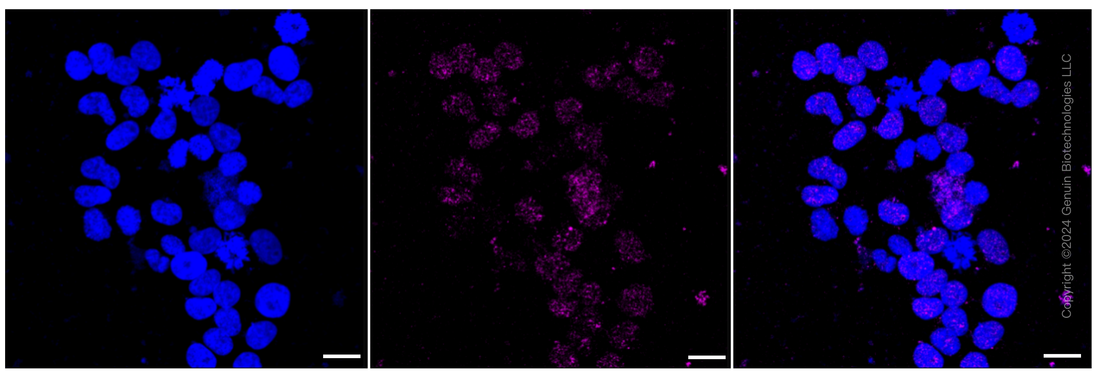 KD-Validated Anti-IQGAP2 Rabbit Monoclonal Antibody ABG1021