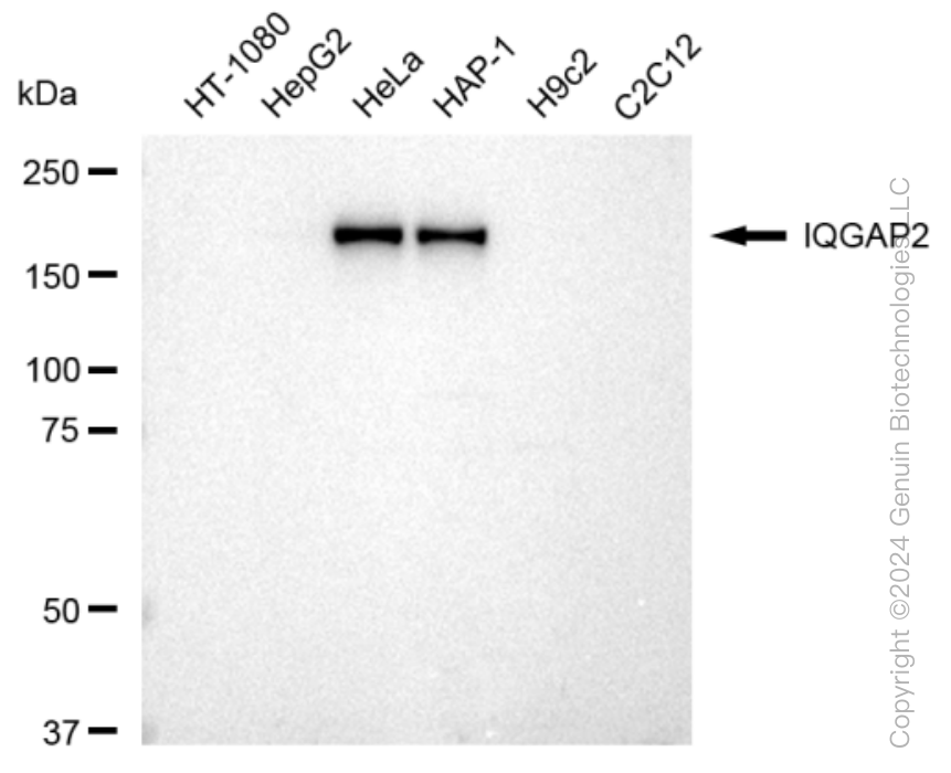 KD-Validated Anti-IQGAP2 Rabbit Monoclonal Antibody ABG1021