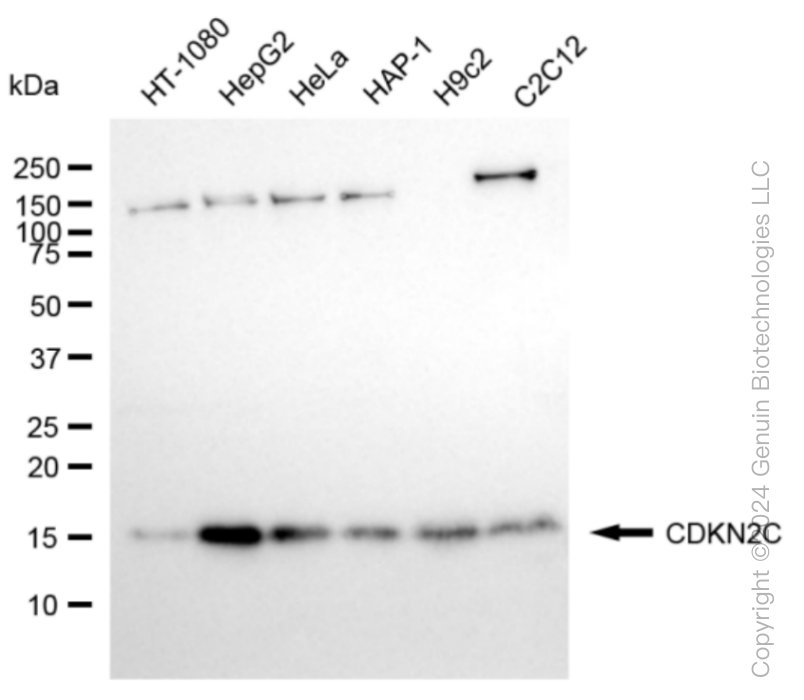 KD-Validated Anti-CDKN2C Rabbit Monoclonal Antibody ABG1022