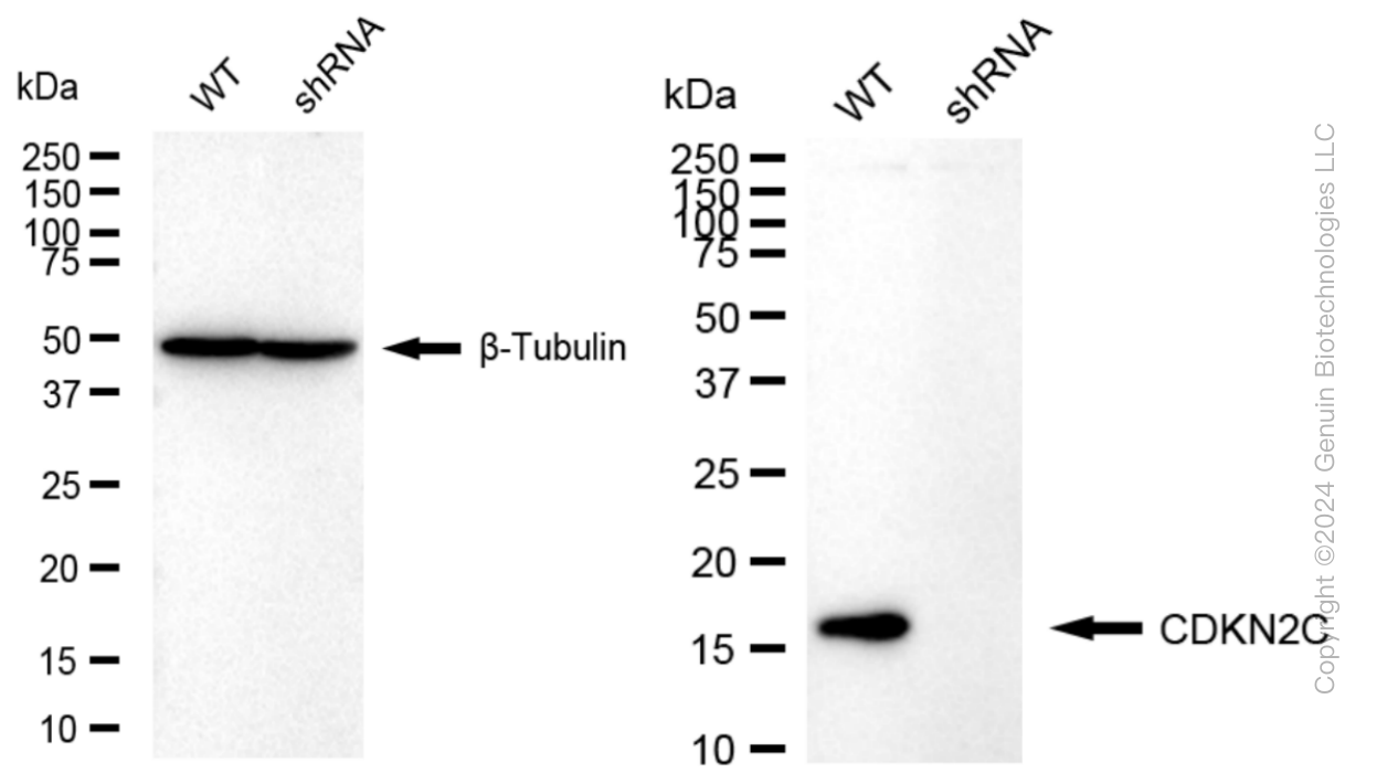 KD-Validated Anti-CDKN2C Rabbit Monoclonal Antibody ABG1022