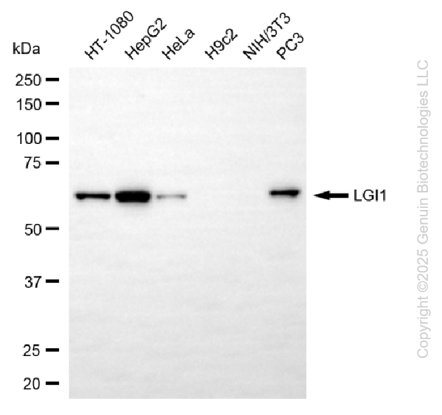 KD-Validated Anti-LGI1 Rabbit Monoclonal Antibody ABG1024