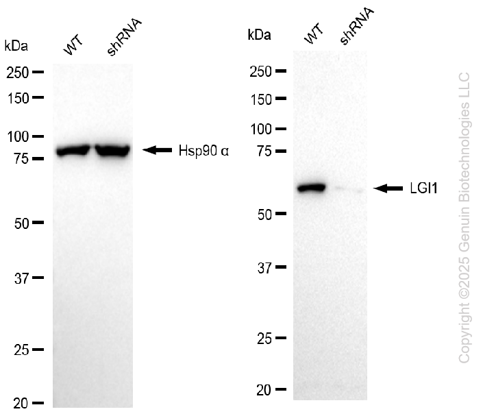 KD-Validated Anti-LGI1 Rabbit Monoclonal Antibody ABG1024