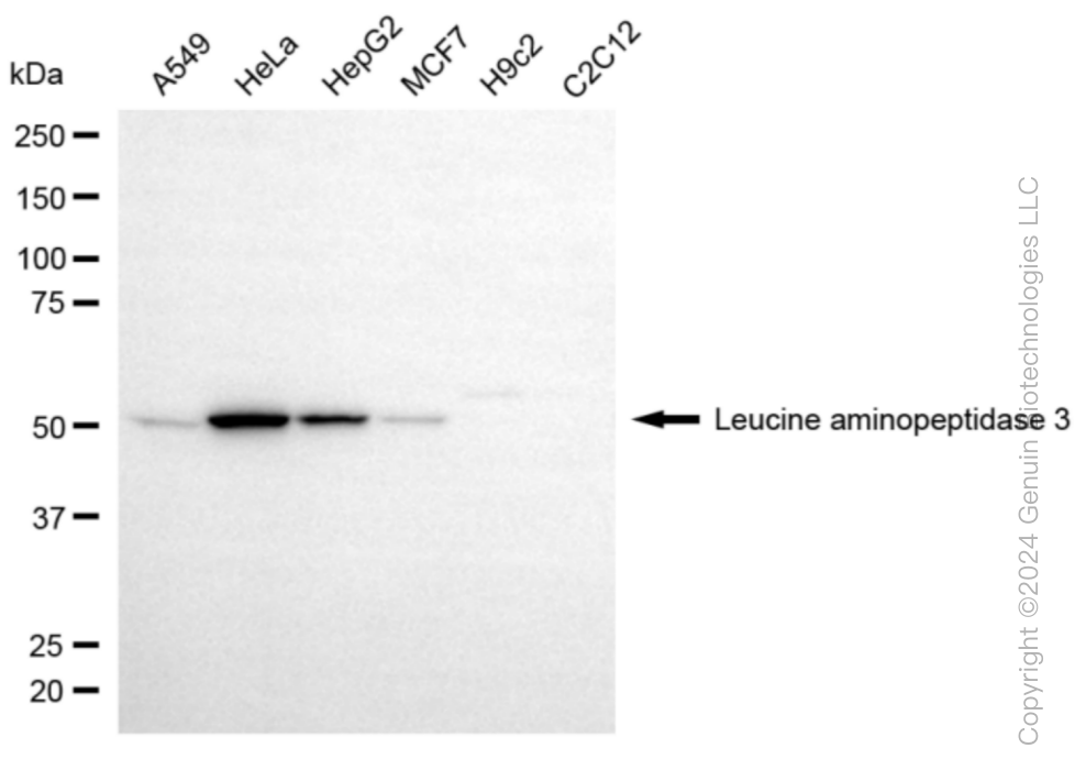 KD-Validated Anti-Leucine aminopeptidase 3 Rabbit Monoclonal Antibody ABG1027