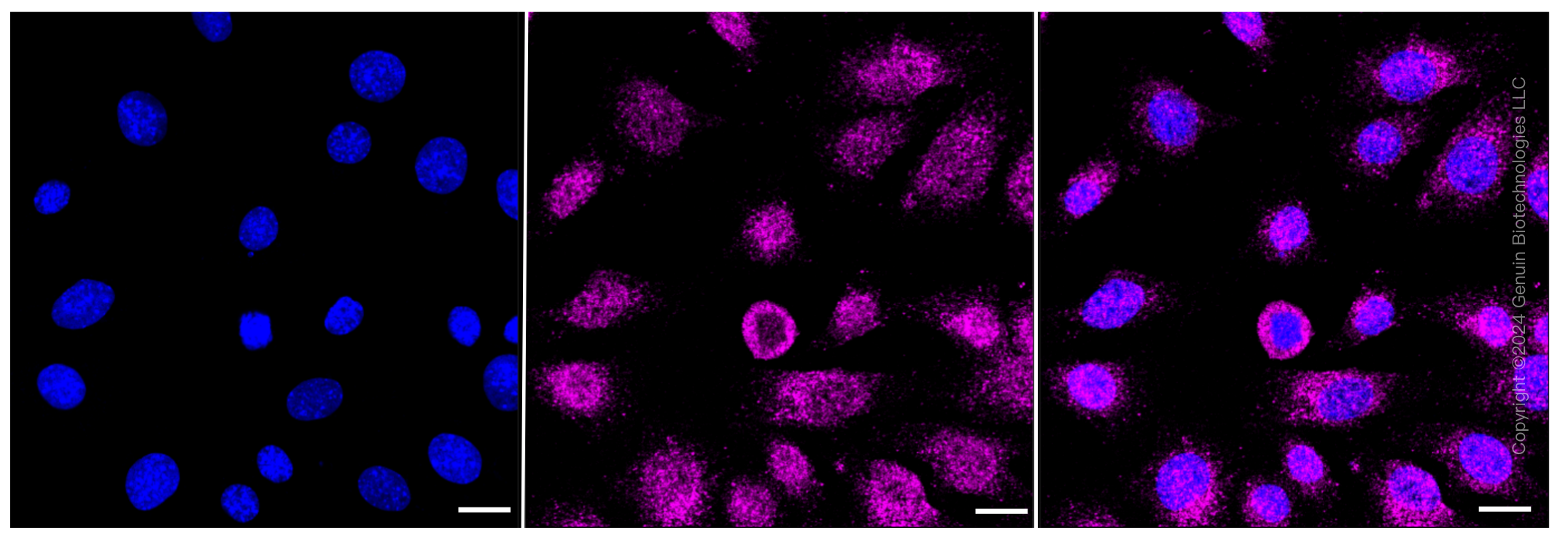 KD-Validated Anti-Calreticulin Rabbit Monoclonal Antibody ABG1028