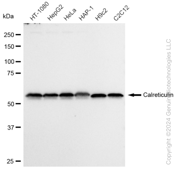 KD-Validated Anti-Calreticulin Rabbit Monoclonal Antibody ABG1028