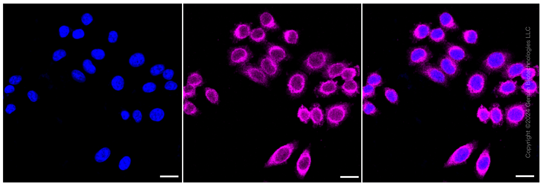 KD-Validated Anti-ROCK2 Rabbit Monoclonal Antibody ABG1029