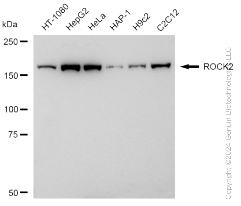 KD-Validated Anti-ROCK2 Rabbit Monoclonal Antibody ABG1029