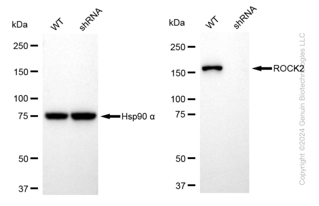 KD-Validated Anti-ROCK2 Rabbit Monoclonal Antibody ABG1029
