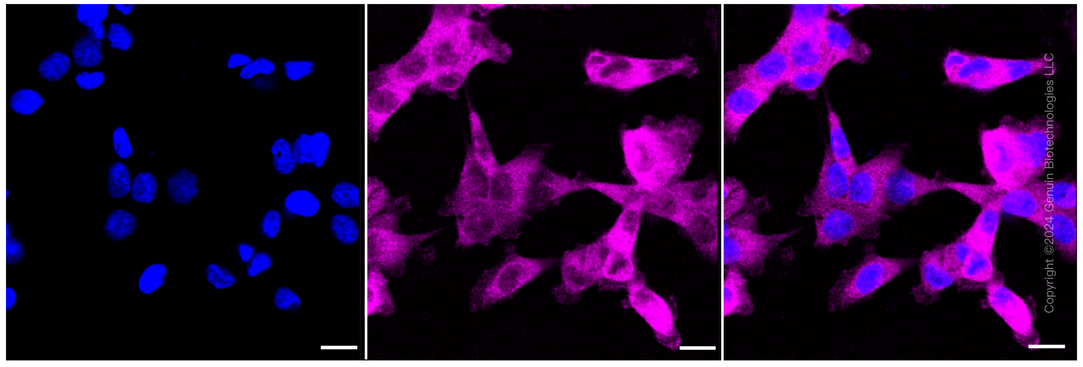 KD-Validated Anti-ATG7 Rabbit Monoclonal Antibody ABG1030