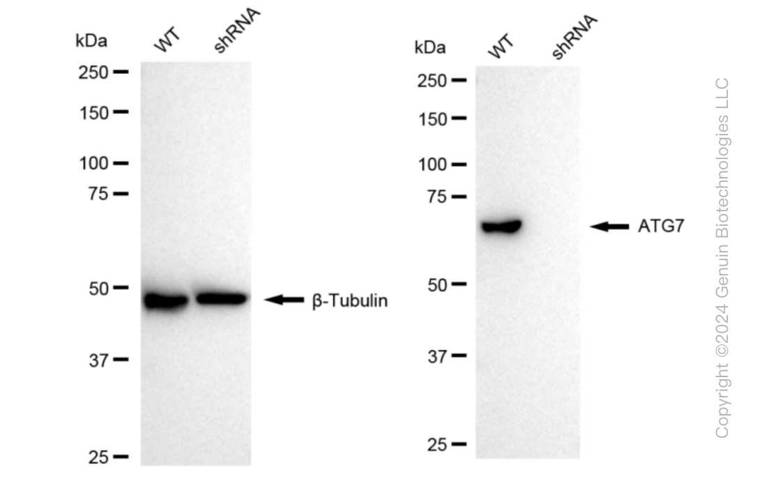 KD-Validated Anti-ATG7 Rabbit Monoclonal Antibody ABG1030