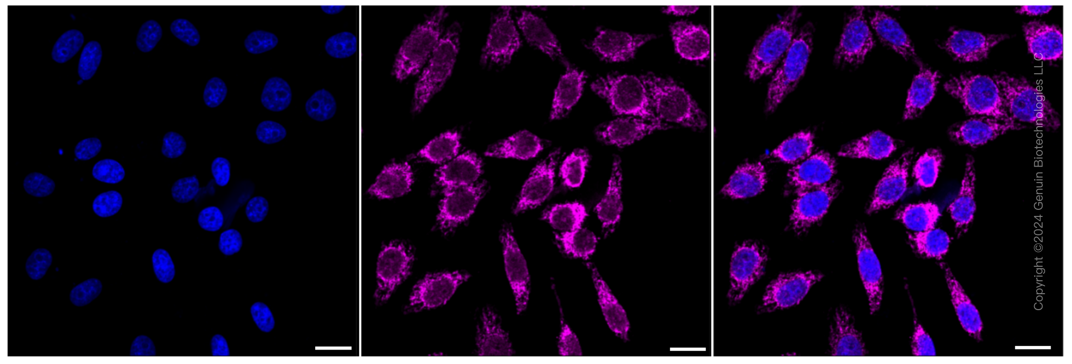 KD-Validated Anti-CLPX Rabbit Monoclonal Antibody ABG1031