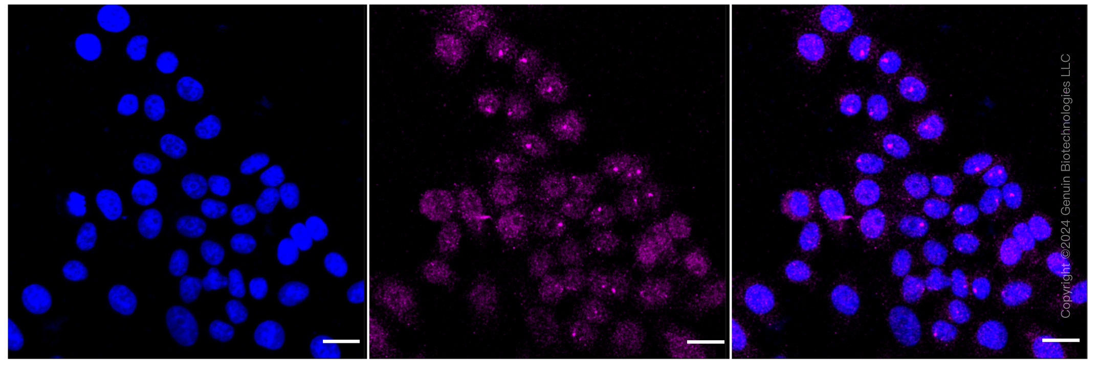KD-Validated Anti-Growth Factor Receptor Bound Protein 7 Rabbit Monoclonal Antibody ABG1035