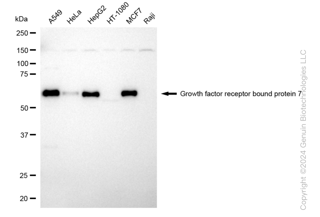 KD-Validated Anti-Growth Factor Receptor Bound Protein 7 Rabbit Monoclonal Antibody ABG1035