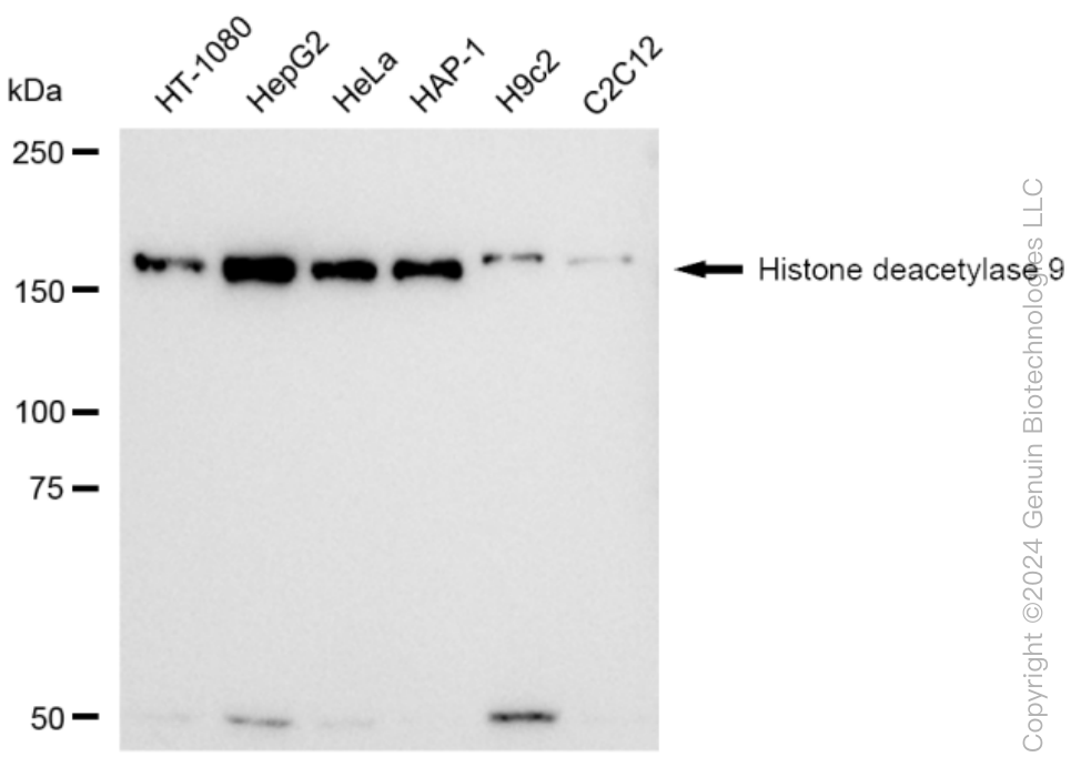 KD-Validated Anti-Histone deacetylase 9 Rabbit Monoclonal Antibody ABG1037