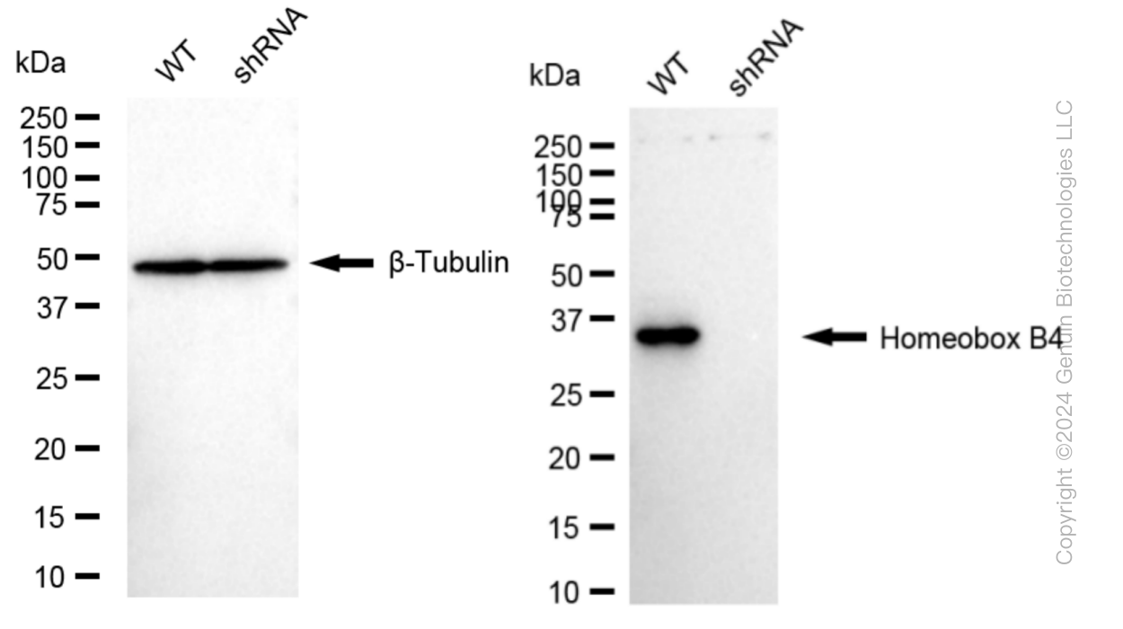 KD-Validated Anti-Homeobox B4 Rabbit Monoclonal Antibody ABG1038