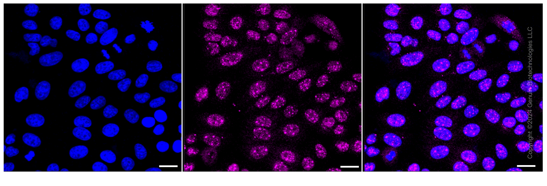 KD-Validated Anti-ITPK1 Rabbit Monoclonal Antibody ABG1042