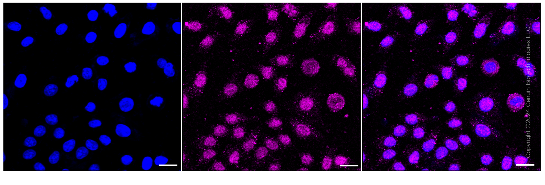 KD-Validated Anti-GTF2F2 Rabbit Monoclonal Antibody ABG1045