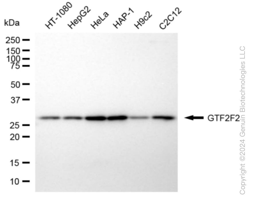KD-Validated Anti-GTF2F2 Rabbit Monoclonal Antibody ABG1045