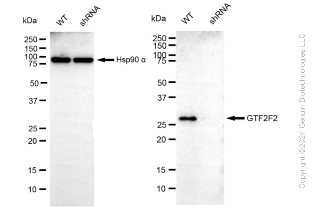 KD-Validated Anti-GTF2F2 Rabbit Monoclonal Antibody ABG1045