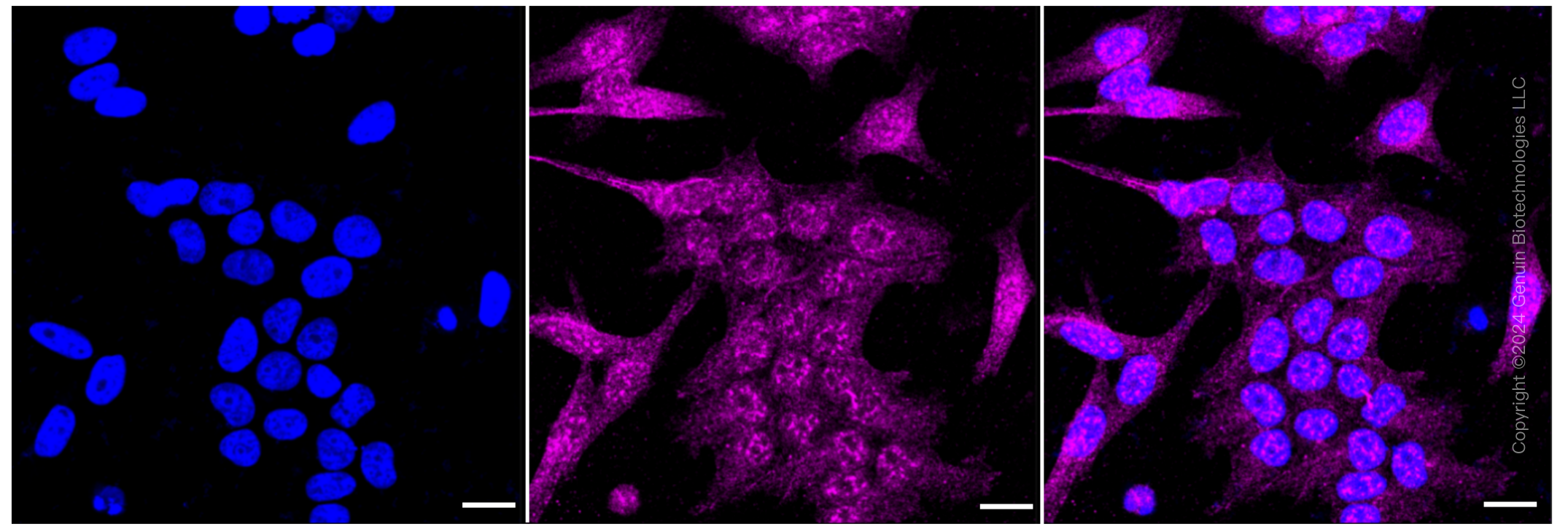 KD-Validated Anti-RPS6KA1 Rabbit Monoclonal Antibody ABG1049
