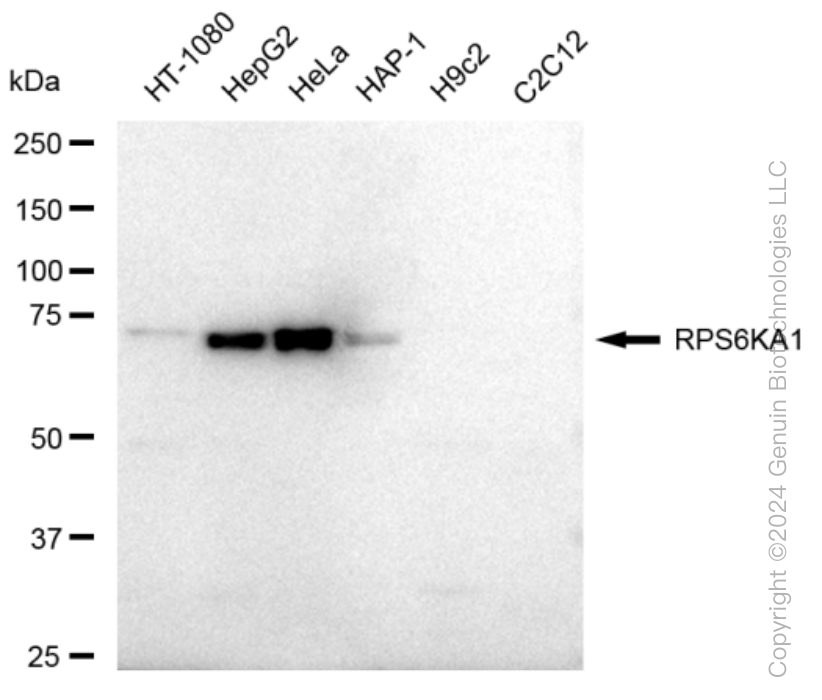 KD-Validated Anti-RPS6KA1 Rabbit Monoclonal Antibody ABG1049