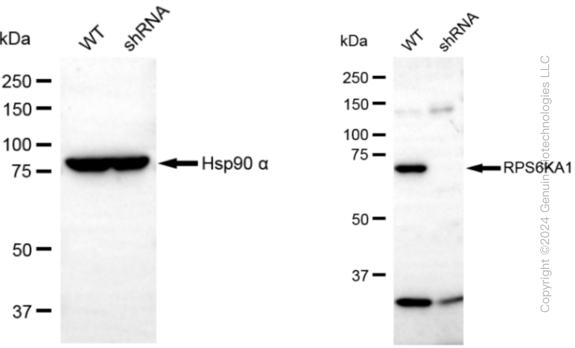 KD-Validated Anti-RPS6KA1 Rabbit Monoclonal Antibody ABG1049