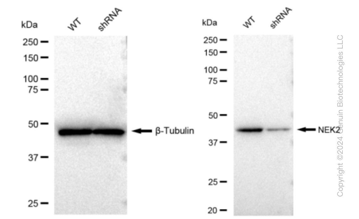 KD-Validated Anti-NEK2 Rabbit Monoclonal Antibody ABG1050