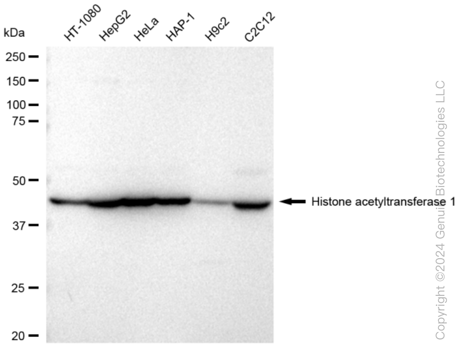 KD-Validated Anti-Histone acetyltransferase 1 Rabbit Monoclonal Antibody ABG1051