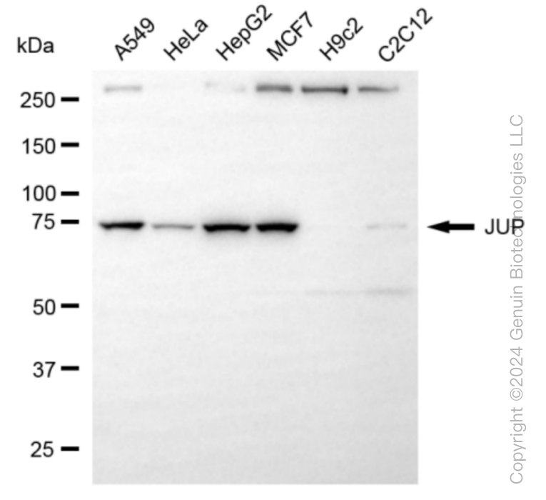 KD-Validated Anti-JUP Rabbit Monoclonal Antibody ABG1054