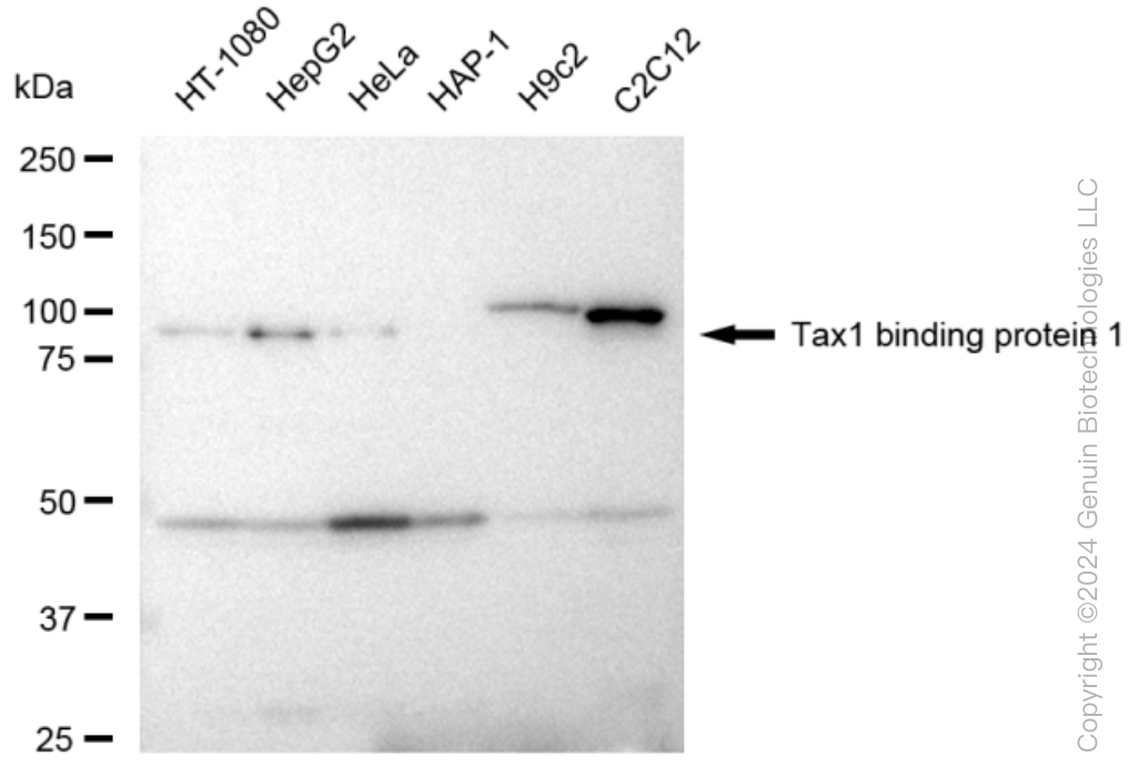 KD-Validated Anti-Tax1 binding protein 1 Rabbit Monoclonal Antibody ABG1055
