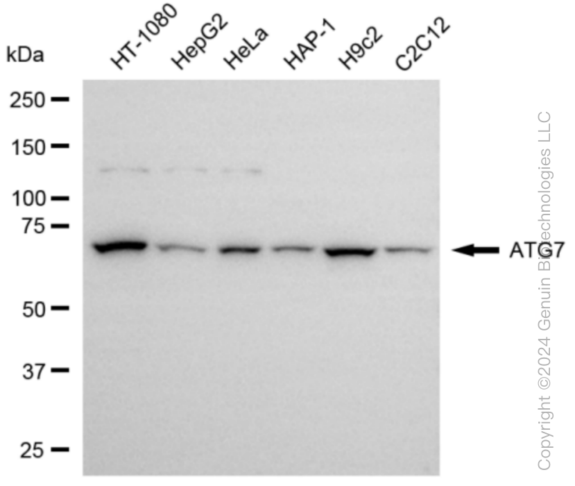 KD-Validated Anti-ATG7 Rabbit Monoclonal Antibody ABG1057