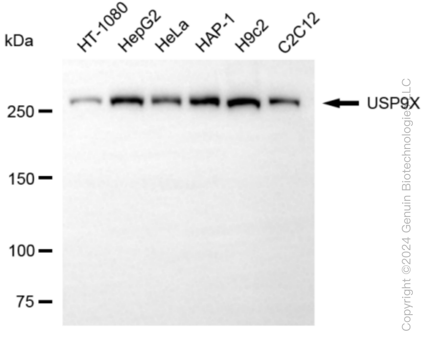 KD-Validated Anti-USP9X Rabbit Monoclonal Antibody ABG1059