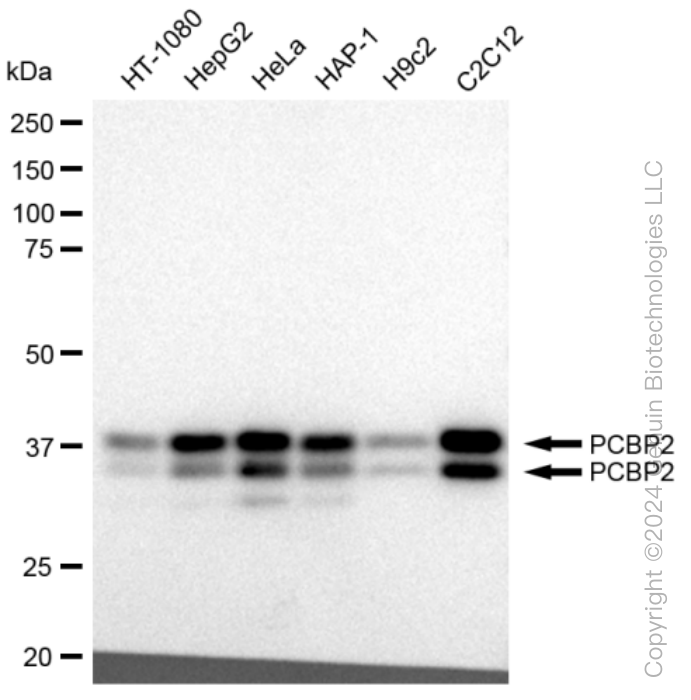 KD-Validated Anti-PCBP2 Rabbit Monoclonal Antibody ABG1061