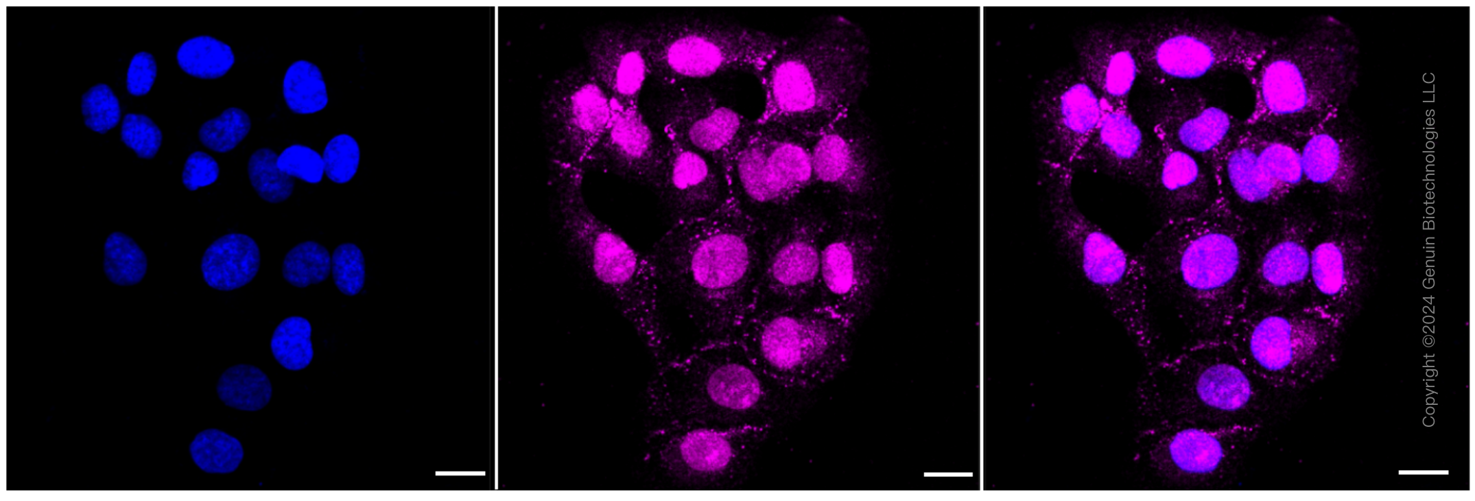 KD-Validated Anti-Inhibin subunit beta B Rabbit Monoclonal Antibody ABG1062